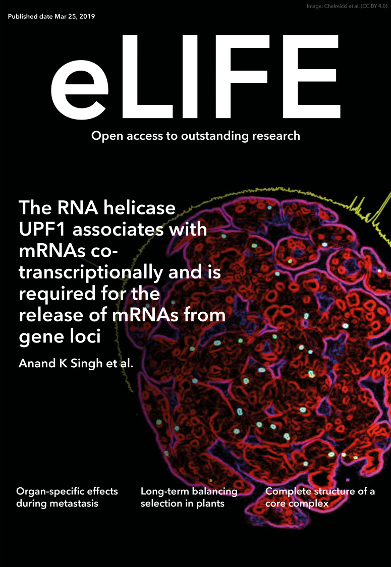 Concomitant activation of GLI1 and Notch1 contributes to racial disparity of human triple negative breast cancer progression